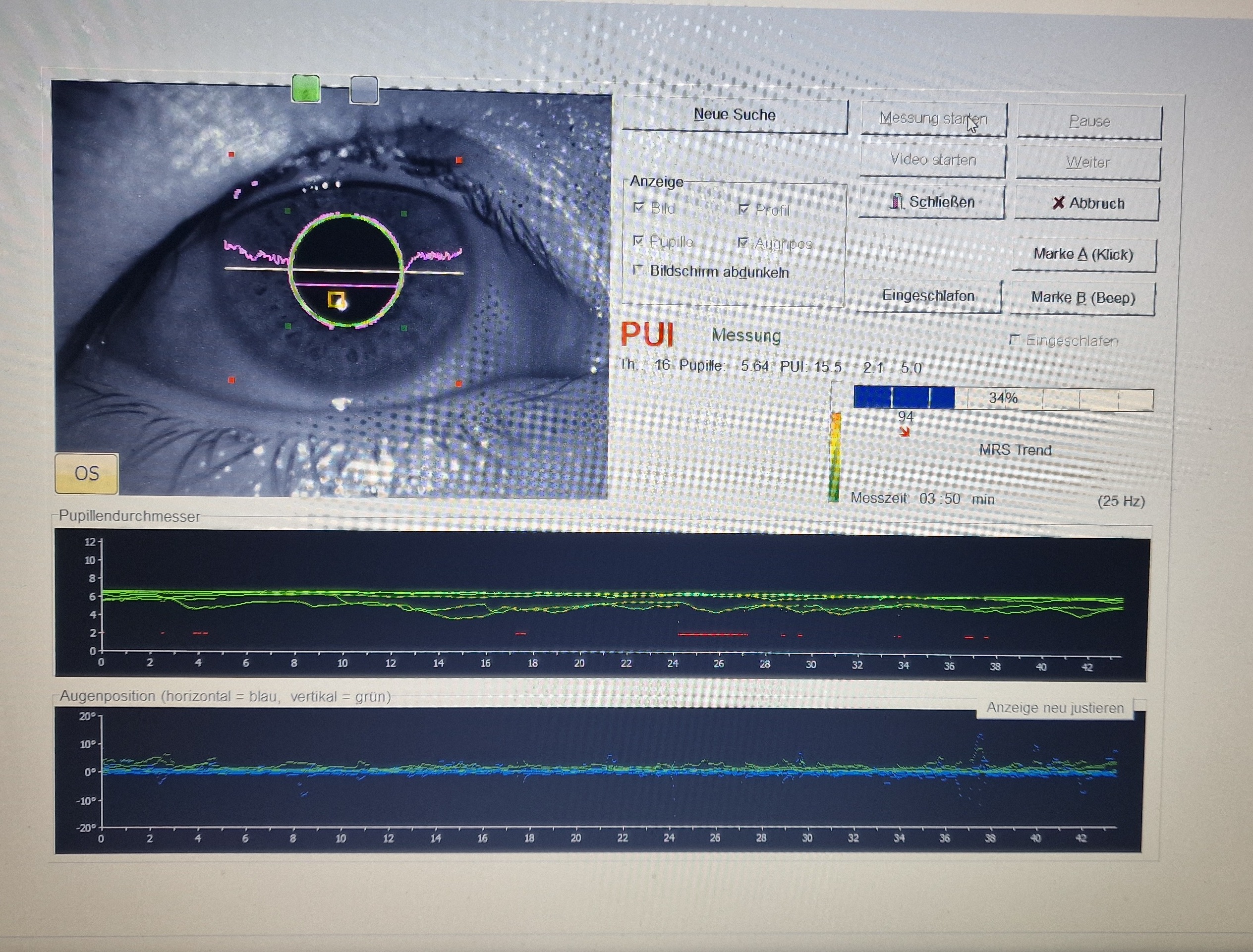 Objektive Ermüdungsmessung im Einsatz: Die Pupillometrie liefert Hinweise auf Aufmerksamkeit, Müdigkeit und Belastung im Schichtalltag.